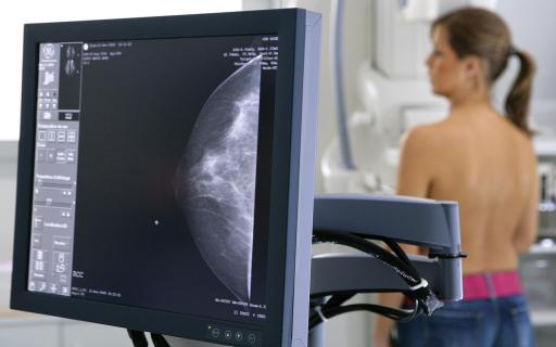 В 2017 году ГБУЗ Центр им. В.П. Аваева осуществлял выезды передвижного маммографа в районы Тверской области