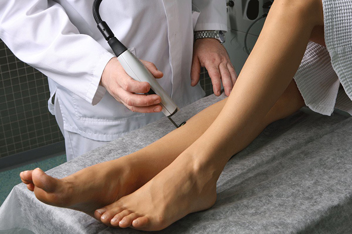 Вены на ногах лечение лазером в твери thumbnail